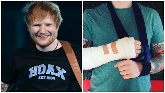 Ed Sheeran / broken arm